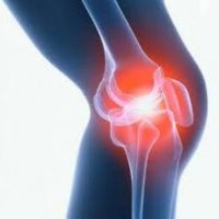Виды синовита коленного сустава и методы их лечения
