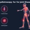 Физиотерапия при заболеваниях суставов: виды и эффективность