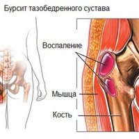 Сайт «Blood Art»: творчество кровью