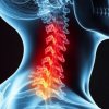 Остеохондроз грудного отдела: почему возникает и как замедлить прогрессирование