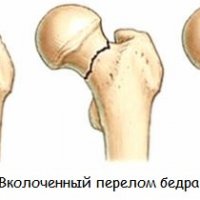 Ливанская гадюка: таинственная красавица Ближнего Востока