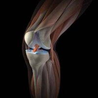 Растяжение связок коленного сустава. Cимптомы, первая помощь и последующее лечение