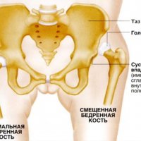 Болезнь души на Руси: история и современность