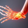 Остеохондроз и синдром запястного канала: комплексная терапия