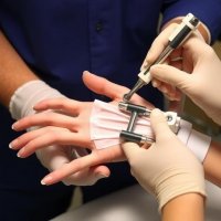 Индивидуальные фиксаторы для запястно‑пястных суставов: зачем нужны и как ими пользоваться