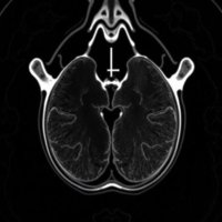 МРТ предстательной железы: что это, зачем и как к нему подготовиться