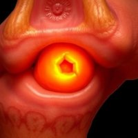 Когда кость подсказывает: современные методы лечения субхондральных кист