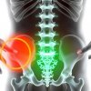 Боль в крестце: сакроилеит или остеохондроз? Как точно понять источник боли и выбрать путь лечения