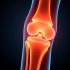 Как не допустить синовит при постоянных нагрузках на суставы: практическое руководство