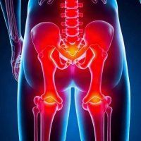 Цистит как причина болей в суставах: редкая связь, о которой стоит знать