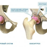 Яванский лангур: удивительный житель тропических лесов