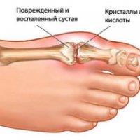 Как пишется слово «болезненно»