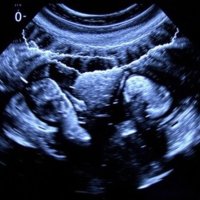 УЗИ без страха: как работает ультразвук, что он показывает и как к нему подготовиться