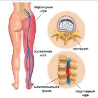 Жук знахарь: удивительные тайны мира мелких целителей