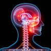 Остеохондроз и зрение: может ли болеть голова из‑за шеи?