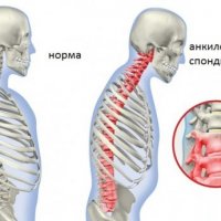 Нильский крокодил: Вес, размер и его уникальная динамика