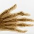 Почему болят суставы пальцев рук и способы их лечения