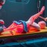 Как правильно организовать транспортировку пациента с политравмой суставов: пошаговый план для команды
