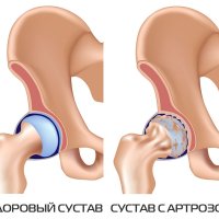 Кивсяк оливковый: загадочный океанский обитатель