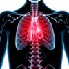Остеохондроз и проблемы с дыханием: редкий симптом