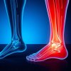 Боль в голеностопе: растяжение связок или начало артроза? Разбираем по полочкам