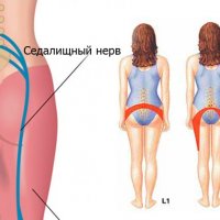 Поединок с невидимыми врагами: почему с вирусами возбудителями заболеваний трудно вести борьбу