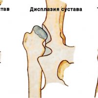 Как использование БСПП изменяет медицинскую практику