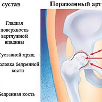 Секреты флебологии: как называется кабинет, где берут кровь