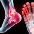 Боль в стопе: плантарный фасциит или артроз плюснефалангового сустава? Как не спутать и что делать дальше
