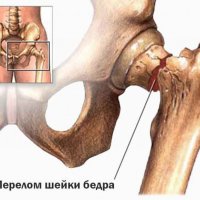 Братание кровью: история, значение и традиции