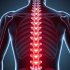 Остеохондроз грудного отдела позвоночника: симптомы, которые нельзя игнорировать