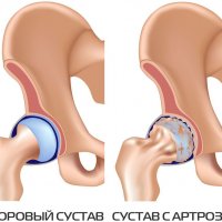 Что за шарик под челюстью: возможные причины и что делать?