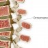 Симптомы, терапия и профилактика остеопороза позвоночника, лучшие способы лечения