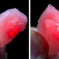Псевдоподагра: как пирофосфатные кристаллы запускают воспаление