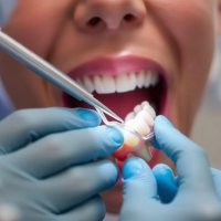 Удаление зуба: что нужно знать, чтобы пройти через это спокойно и без лишних сюрпризов