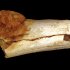 Что такое энхондрома бедренной кости?