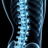 Грыжа межпозвоночного диска при остеохондрозе: когда нужна операция?