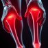 Как распознать артроз на начальной стадии: признаки, проверка и шаги к замедлению процесса