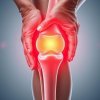 Бурсит коленного сустава: как лечить и ухаживать за коленями в пожилом возрасте