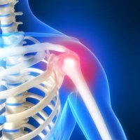 Причины и лечение боли в плечевом суставе