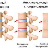 Уж гадюковый: Тайны обитателя водоемов и его уникальная экология