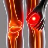 Артроз: как распознать первые признаки и не пропустить момент