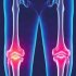 Операции на суставах при ревматоидном артрите: какие риски важно понимать заранее