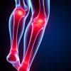 Железо, суставы и усталость: как дефицит железа влияет на артроз