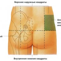 Труд для человека: здоровье и жизнь