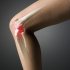 Гонартроз коленного сустава: лечение, симптомы, причины