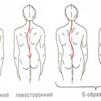 Медицинский спирт: какой он должен быть по ГОСТу?