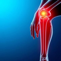 Артроз: причины и методы профилактики для долгой жизни без боли