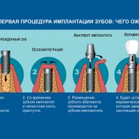 Очковый какаду: загадочный лисенок мира пернатых