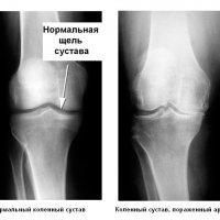 Поцелуй опасности: Исследуем мир экзотичного паука Poecilotheria fasciata